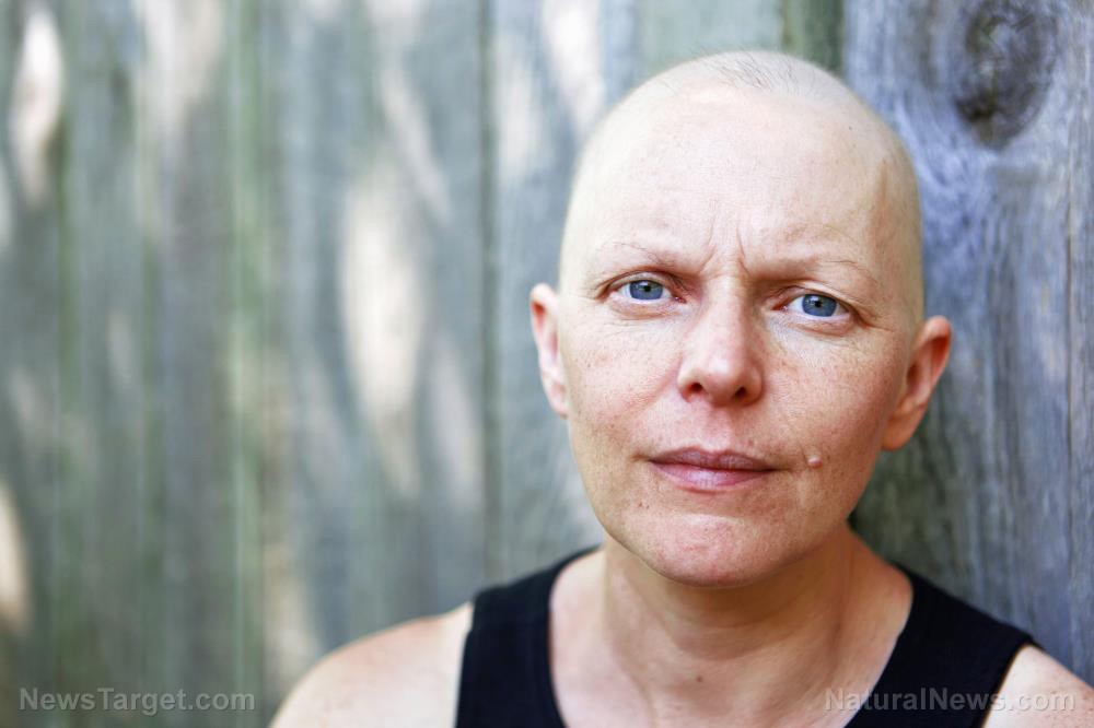 Cancer-Patient-Chemo-Chemotherapy-Hair-Treatment-Women.jpg